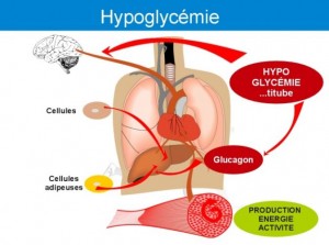 Hypoglycémie