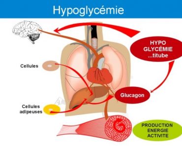 Hypoglycémie